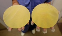 Súd rozhodol v kauze nekvalitných prsných implantátov, desiatky tisíc žien sa dočkajú odškodného
