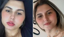 Prvé na svete. Brazílske dvojičky podstúpili simultánnu zmenu pohlavia