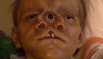 Trpeli a zarábali. V Nitre si môžete pozrieť figuríny ľudí s chorobami