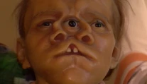Trpeli a zarábali. V Nitre si môžete pozrieť figuríny ľudí s chorobami