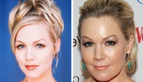 Aj ona podľahla plastike. Kelly z Beverly Hills natiahnutá a pribratá