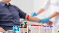 Vedci vyvinuli test, ktorý pacientom s rakovinou povie, či zvládnu chemoterapiu