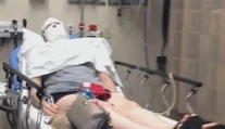 Žena chcela sfúknuť sviečku, tá jej však explodovala rovno do tváre