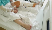 Žena po uhryznutí psom dostala infekciu a začalo jej odumierať tkanivo