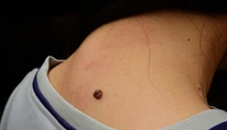 Bolí vás z home officu krčná chrbtica? Poradíme vám cviky a triky ako s tým bojovať