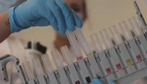 Niečo tu nesedí. Hoci sme na vrchole pandémie, v medzinárodnej štatistike Slovensku počet nakazených klesá