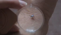 Kliešte už zrejme budeme mať celoročne. Na jedno z ochorení, ktoré prenášajú, sa však pripravuje vakcína