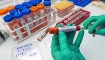 Koordinátor boja proti covidu radí nespoliehať sa na kolektívnu imunitu