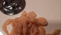 VIDEO: Muža vyľakal na toalete hrozivý pohľad. Z tela si vybral živú pásomnicu