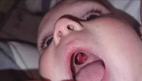 Ženu vystrašila diera v ústach bábätka. Keď sestrička zistila, o čo ide, smiech sa im nezastavil
