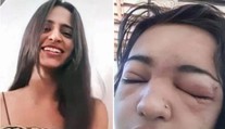 Odignorovala zákaz matky. Izabela (†15) si sama prepichla obočie, zomrela na ťažkú infekciu