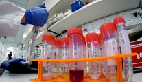 Vedcom sa podarila prevratná vec. Vytvorili zvieracie embryo s ľudskými bunkami
