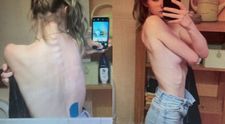Kráska z Ruže si prešla peklom: Vážila 40 kg a myslela na to najhoršie