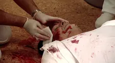 Ordinácia v ružovej záhrade: Trauma