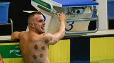 Zaujali vás červené kruhy na športovcoch a neviete, z čoho sú? Vysvetlenie je jednoduché