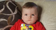 Tento chlapec sa nikdy neusmeje. Trpí vzácnou chorobou