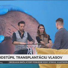 Martin Koči rozprával v Teleráne o transplantácii vlasov.