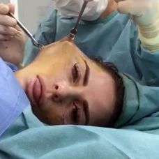 Katie Price počas chirurgického zákroku