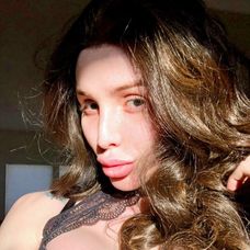 Kyleigh Potts sa chcel čo najviac podobať na reality hviezdu Kylie Jenner