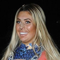Chloe Ferry po plastike nosa. 
