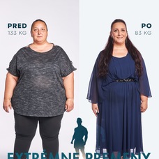 Ružena schudla 50 kíl