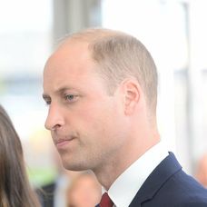 Princ William má nad ľavým obočím jazvu