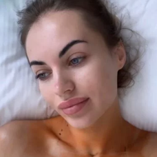 Natálie ukázala po zmenšení poprsia fotky z kliniky.