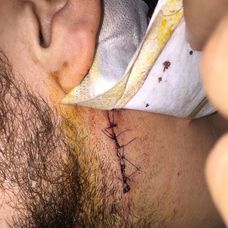 Nechýbalo veľa a súperova korčuľa mohla zasiahnuť tepnu