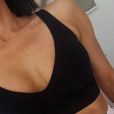 Lucia Gašparíková podstúpila explantáciu prsných implantátov.