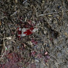 Šimon si škaredo porezal ruku