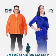 Karina Šafrániková v šou Extrémne premeny Slovensko: Druhá šanca na život (Pred a Po)