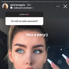 Dievčatá sa netaja plastickými zákrokmi