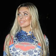 Chloe Ferry po plastike nosa. 