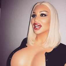Ivana Vladislava po odstránení silikónu.