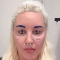 Amanda Bynes po operácii