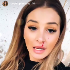 Zuzanu Plačkovú doškriabalo tigrie mláďa. 