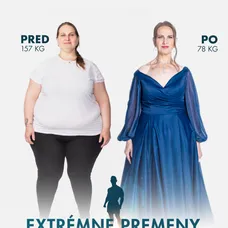 Kamila Zemančíková v šou Extrémne premeny Slovensko - Druhá šanca na život (Pred a Po)