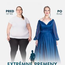 Kamila Zemančíková v šou Extrémne premeny Slovensko - Druhá šanca na život (Pred a Po)