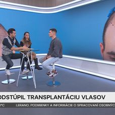 Martin Koči rozprával v Teleráne o transplantácii vlasov.