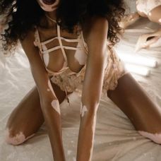 Winnie Harlow 