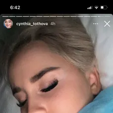 Cynthia absolvovala operačný zákrok
