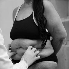 Ružena pred premenou