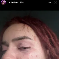 Ráchel Karnižová zverejnila fotky po bitke a správy plné vulgarizmov