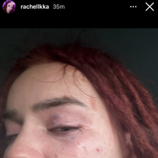 Ráchel Karnižová zverejnila fotky po bitke a správy plné vulgarizmov