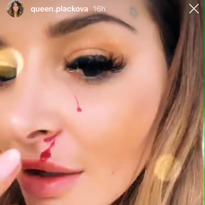 Zuzanu Plačkovú doškriabalo tigrie mláďa. 