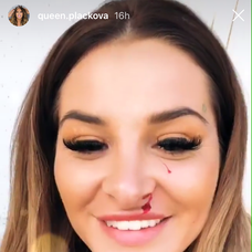 Zuzanu Plačkovú doškriabalo tigrie mláďa. 