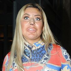 Chloe Ferry po plastike nosa. 