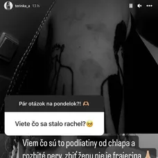 Tereza Kosecová zverejnila fotky po bitke