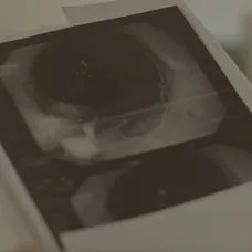 Bývallí manželia nie sú na vážnu diagnózu pripravení.
