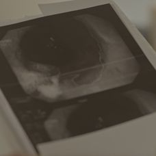 Bývallí manželia nie sú na vážnu diagnózu pripravení.